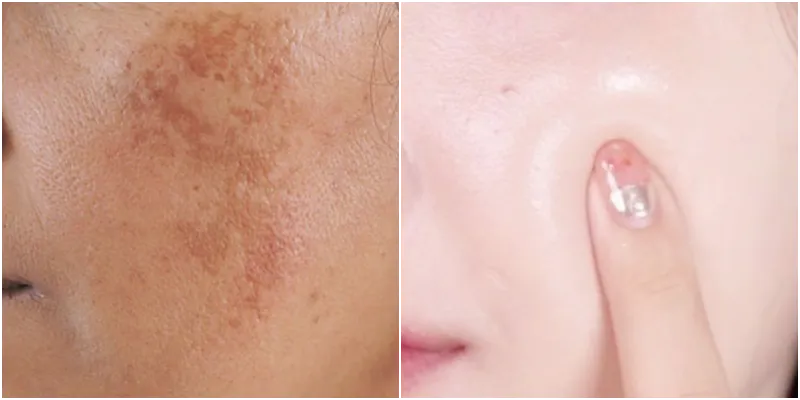 SAAM Renewal Face Cream