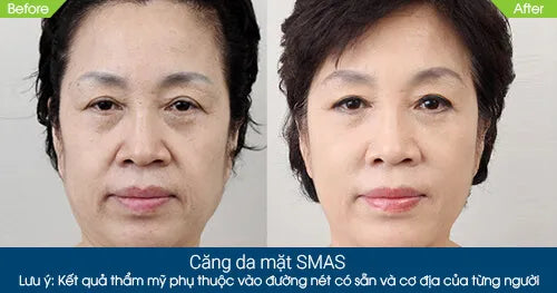 SAAM Renewal Face Cream